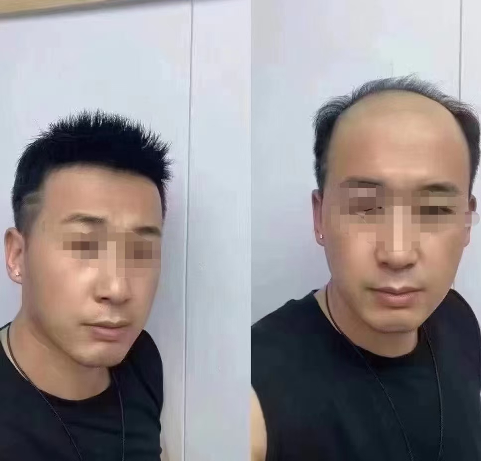 千丝美：让南阳脱发男士重焕生机