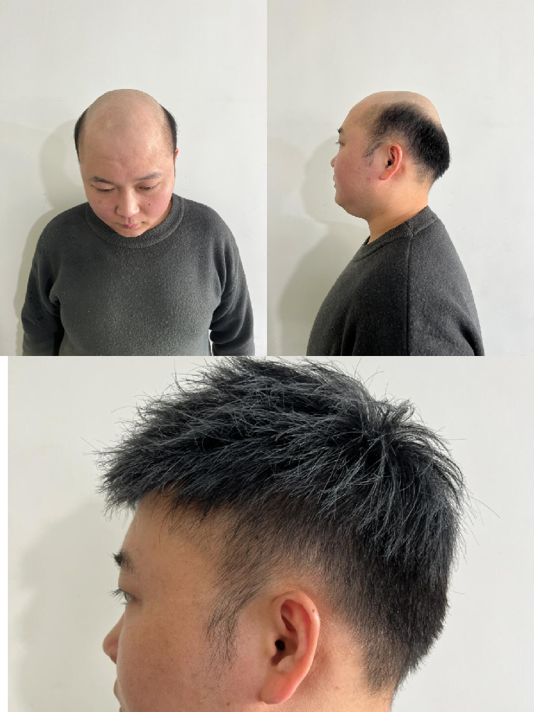 男士假发定制哪里好？南阳千丝美隐形定制，效果自然看得见！​