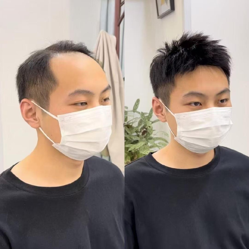 男士假发