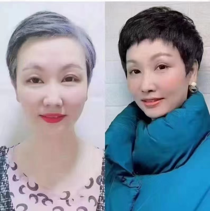 她还是当年的样子——张大姐白发增发实录