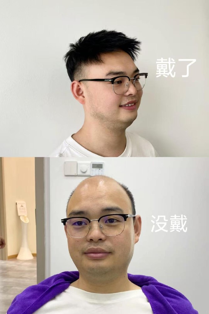 南阳哪有可以定做男士假发的地方？推荐南阳千丝美补发假发定制服务