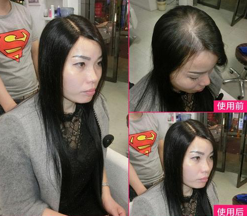 河南高端时尚假发哪家好？发量少怎么办？