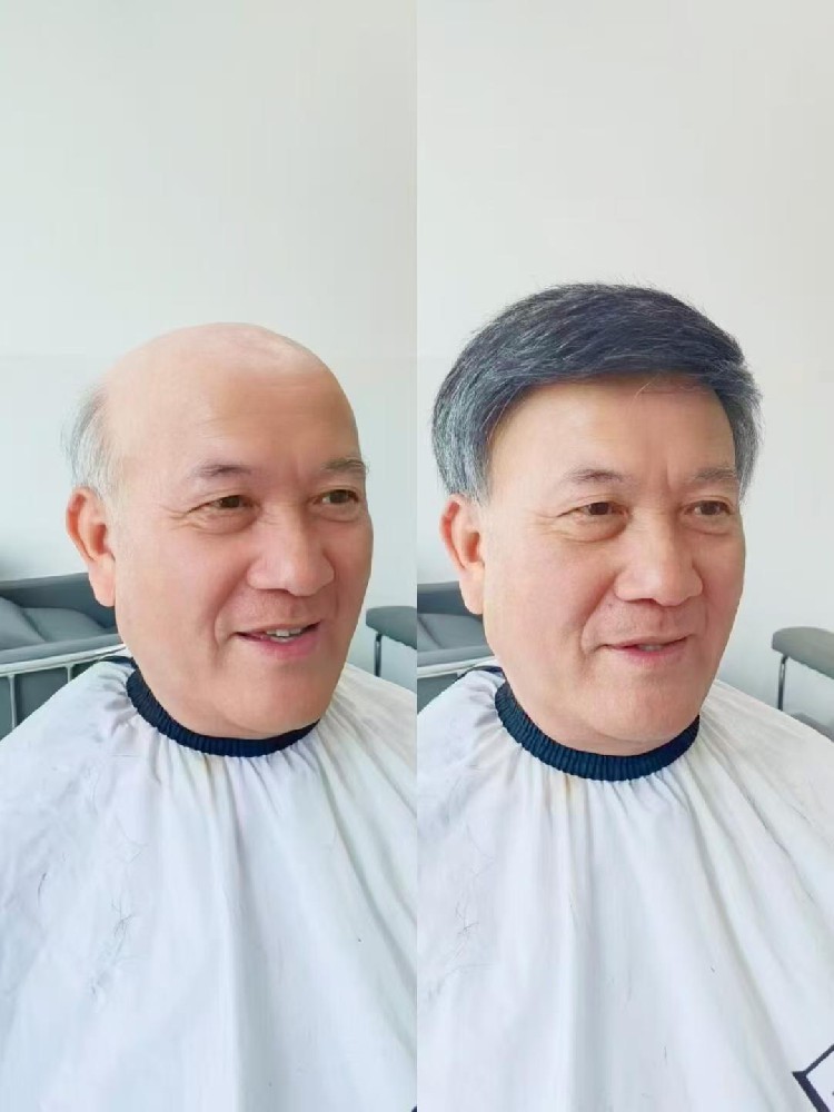 头发逐渐变少怎么办？假发或许是值得尝试的选择