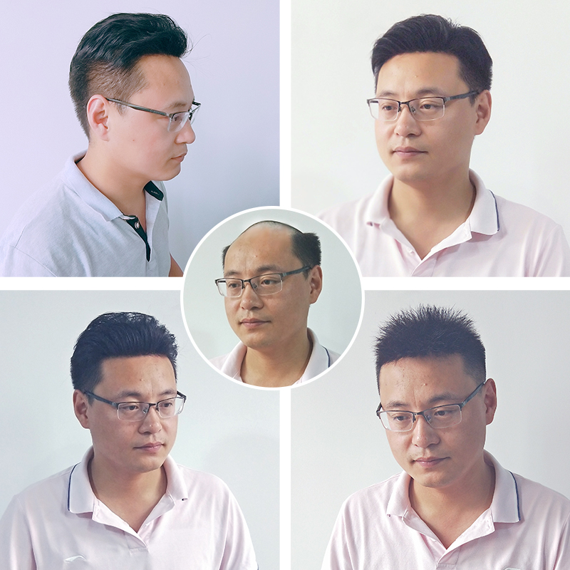 告别秃头焦虑：如何选到自然不显眼的男士假发
