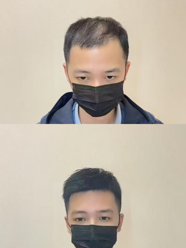 男士假发