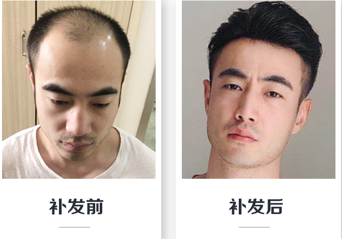 南阳高档假发