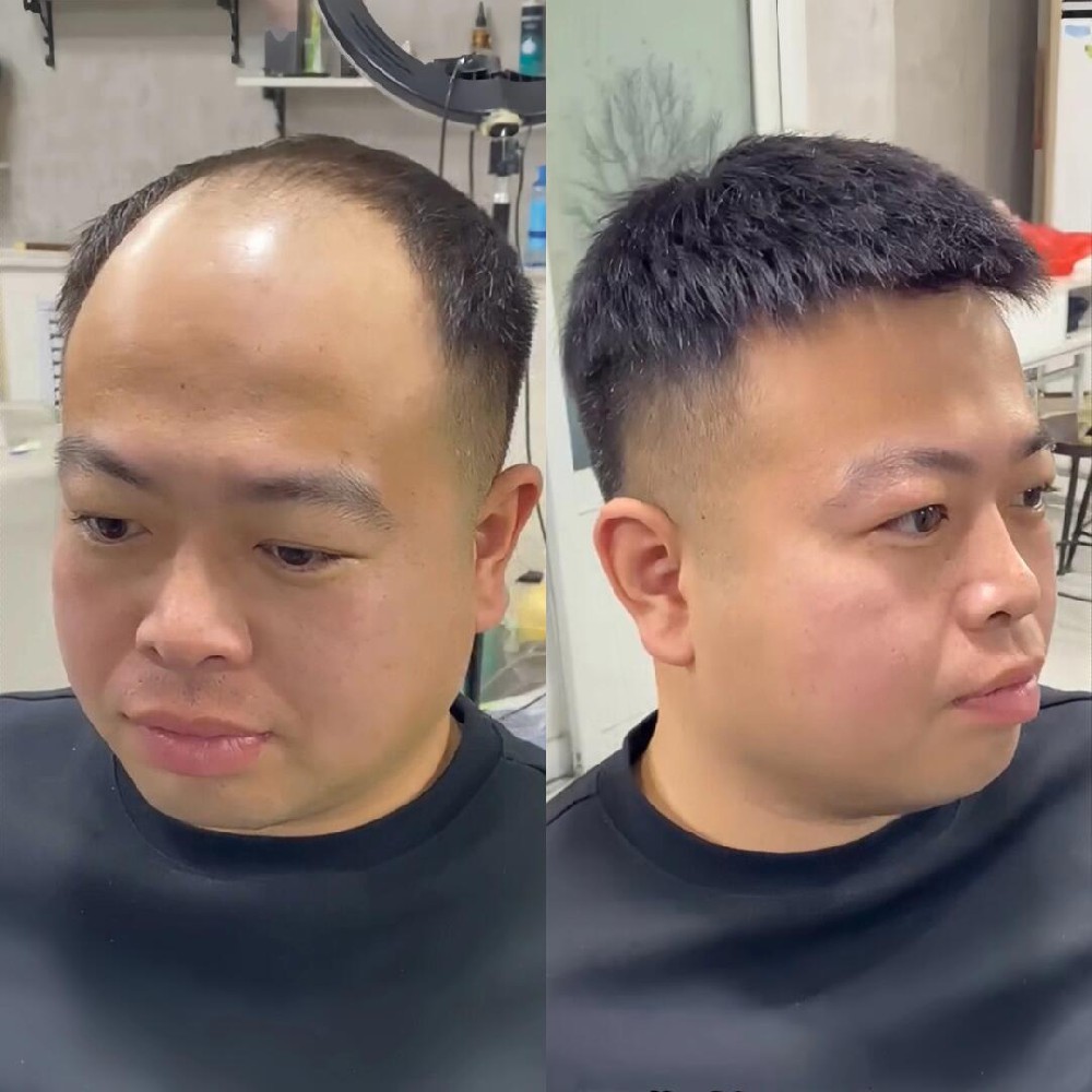 南阳假发:为您量身定制的自信选择 南阳假发:为您量身定制的自信选择