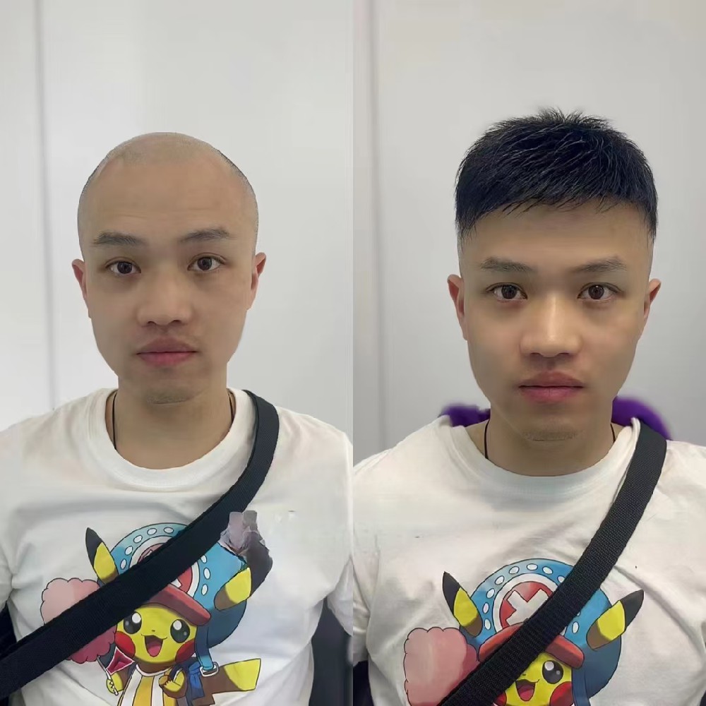 南阳千丝美：用专业定制，帮您重拾浓密秀发