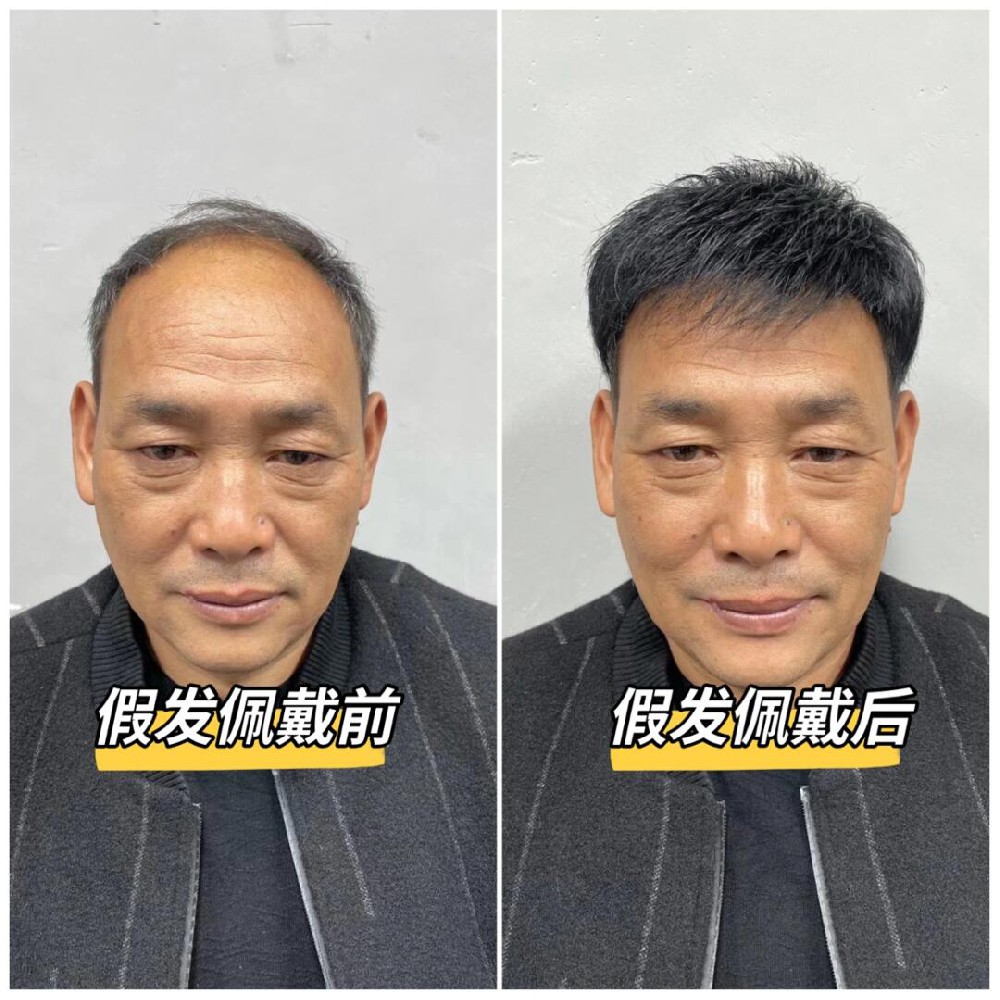 南阳假发别踩坑！千丝美定制：戴得稳、看不穿，南阳人自己的安心选择