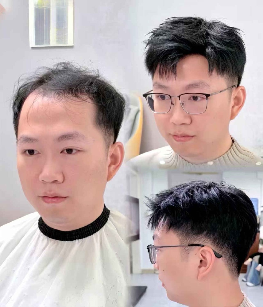 南阳千丝美补发假发定制中心：专业解决脱发困扰的首选机构