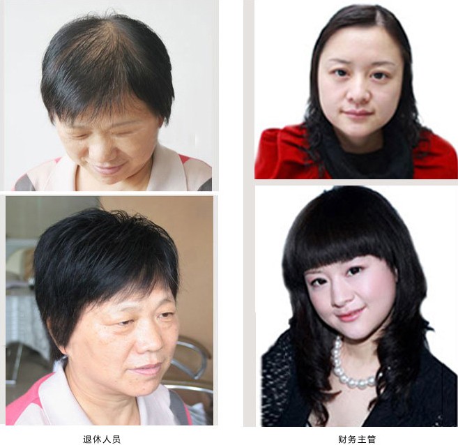 南阳千丝美补发假发定制中心：告别白发困扰的优选方案