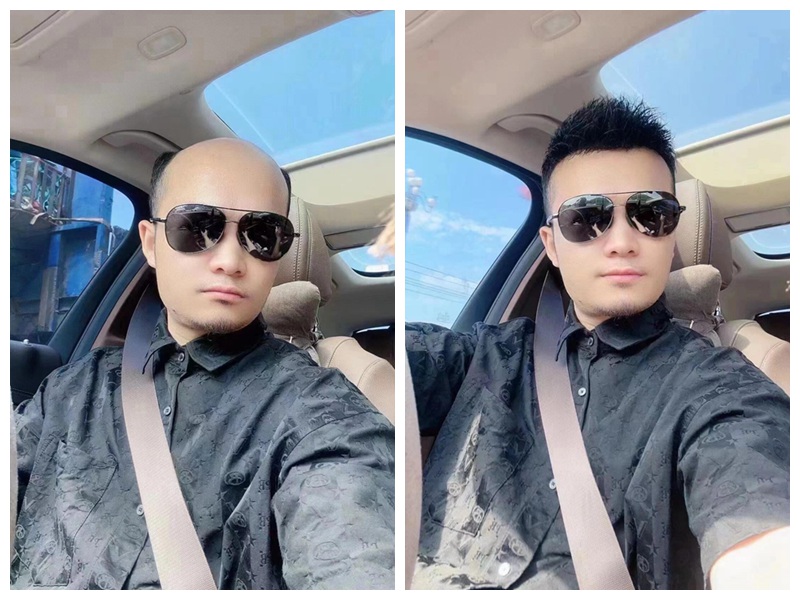 南阳朋友，头发稀疏别发愁，这个“隐形”法子让生活重新得劲！