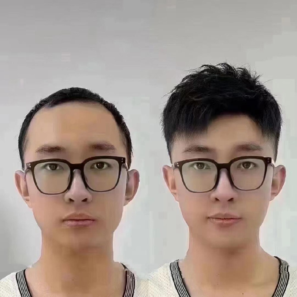 南阳千丝美假发定制：脱发党避坑指南，25岁小伙的真实逆袭之路