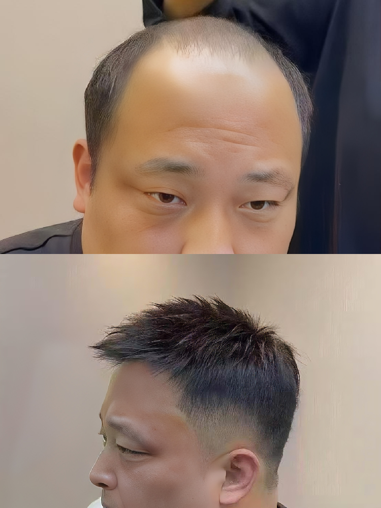 南阳假发定制哪家靠谱？千丝美深耕本地 专业物理补发自然无痕