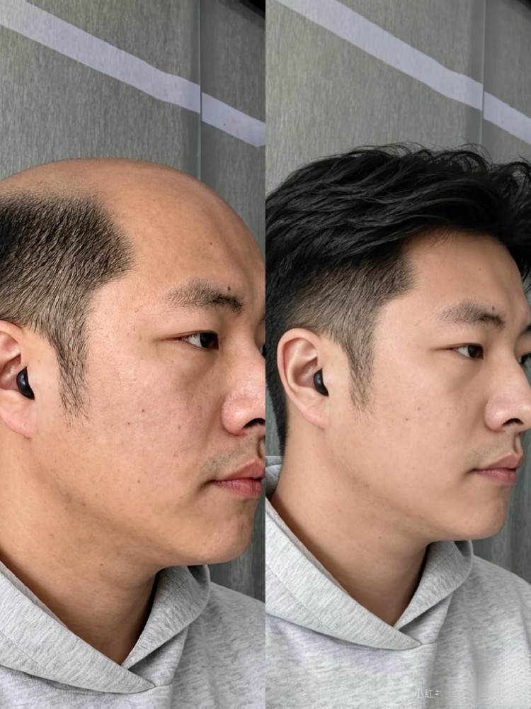 南阳人养发避坑提醒：脱发白发别乱试，选对方法少走弯路