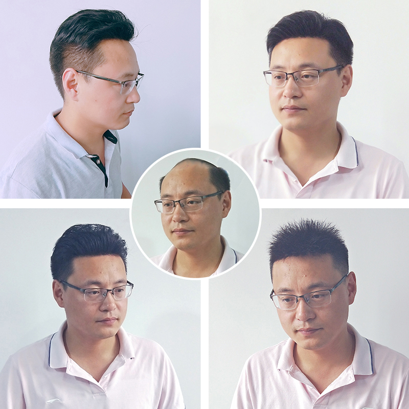 南阳物理增发技术好在哪？推荐南阳千丝美补发假发定制中心